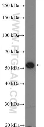 Calreticulin Antibody in Western Blot (WB)