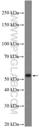 Calreticulin Antibody in Western Blot (WB)