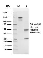 Glutamate-Cysteine Ligase Regulatory Subunit Antibody in SDS-PAGE (SDS-PAGE)