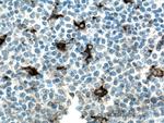 MMP9 Antibody in Immunohistochemistry (Paraffin) (IHC (P))