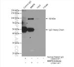 MMP9 Antibody in Immunoprecipitation (IP)