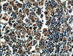 COX2/ Cyclooxygenase 2 Antibody in Immunohistochemistry (Paraffin) (IHC (P))