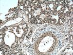 COX2/ Cyclooxygenase 2 Antibody in Immunohistochemistry (Paraffin) (IHC (P))