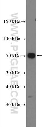 COX2/ Cyclooxygenase 2 Antibody in Western Blot (WB)