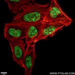 KI67 Antibody in Immunocytochemistry (ICC/IF)