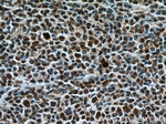 KI67 Antibody in Immunohistochemistry (Paraffin) (IHC (P))