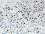 KI67 Antibody in Immunohistochemistry (Paraffin) (IHC (P))