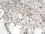 KI67 Antibody in Immunohistochemistry (Paraffin) (IHC (P))