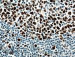 KI67 Antibody in Immunohistochemistry (Paraffin) (IHC (P))