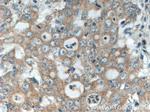 EDEM3 Antibody in Immunohistochemistry (Paraffin) (IHC (P))