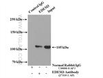 EDEM3 Antibody in Immunoprecipitation (IP)