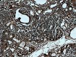 AAGAB Antibody in Immunohistochemistry (Paraffin) (IHC (P))