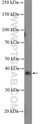 AAGAB Antibody in Western Blot (WB)