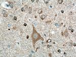 Beta Amyloid Antibody in Immunohistochemistry (Paraffin) (IHC (P))