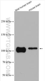 Beta Amyloid Antibody in Western Blot (WB)