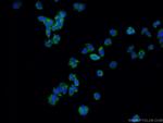 CNTF Antibody in Immunocytochemistry (ICC/IF)