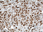 RARS Antibody in Immunohistochemistry (Paraffin) (IHC (P))