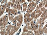 RARS Antibody in Immunohistochemistry (Paraffin) (IHC (P))