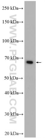 RARS Antibody in Western Blot (WB)