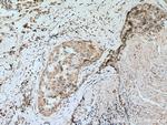 SEMA4A Antibody in Immunohistochemistry (Paraffin) (IHC (P))