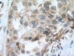 SEMA4A Antibody in Immunohistochemistry (Paraffin) (IHC (P))