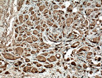 ADAL Antibody in Immunohistochemistry (Paraffin) (IHC (P))