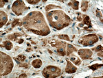 ADAL Antibody in Immunohistochemistry (Paraffin) (IHC (P))