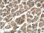 ADAL Antibody in Immunohistochemistry (Paraffin) (IHC (P))