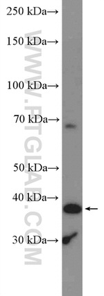 ADAL Antibody in Western Blot (WB)