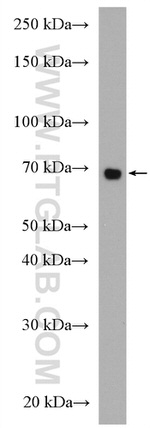 IL2RG Antibody in Western Blot (WB)