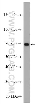 IL2RG Antibody in Western Blot (WB)