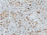 DVL1 Antibody in Immunohistochemistry (Paraffin) (IHC (P))