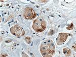 DVL1 Antibody in Immunohistochemistry (Paraffin) (IHC (P))