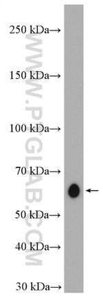 ABI1 Antibody in Western Blot (WB)