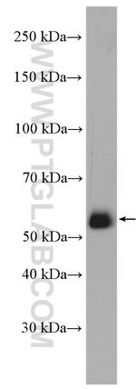 ABI1 Antibody in Western Blot (WB)