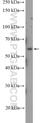 ABI1 Antibody in Western Blot (WB)