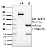 Glyoxalase 1 (GLO1) Antibody in SDS-PAGE (SDS-PAGE)