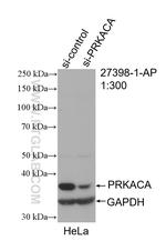 PRKACA Antibody in Western Blot (WB)