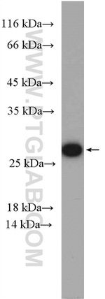 RAB5B Antibody in Western Blot (WB)