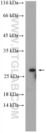 RAB5B Antibody in Western Blot (WB)