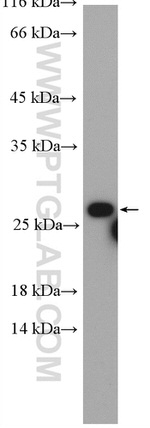 RAB5B Antibody in Western Blot (WB)