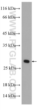 RAB5B Antibody in Western Blot (WB)