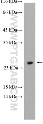 RAB5B Antibody in Western Blot (WB)