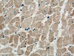 NPPA Antibody in Immunohistochemistry (Paraffin) (IHC (P))