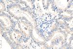 NODAL Antibody in Immunohistochemistry (Paraffin) (IHC (P))