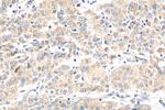 NODAL Antibody in Immunohistochemistry (Paraffin) (IHC (P))