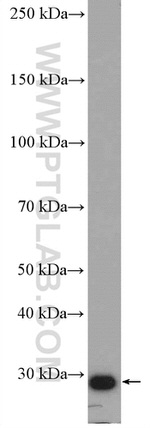 RAB34 Antibody in Western Blot (WB)