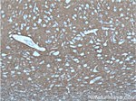 CACNA2D1 Antibody in Immunohistochemistry (Paraffin) (IHC (P))