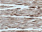 CACNA2D1 Antibody in Immunohistochemistry (Paraffin) (IHC (P))