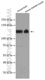 CACNA2D1 Antibody in Western Blot (WB)